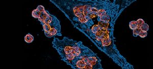 Cancer, Inflammation, and Immunity June 11 - 13, 2017, San Diego, CA, USA