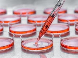Cell Culture